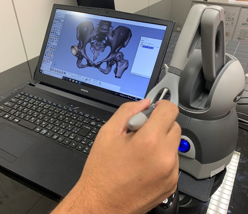 3D-CAD技術を用いた術前計画