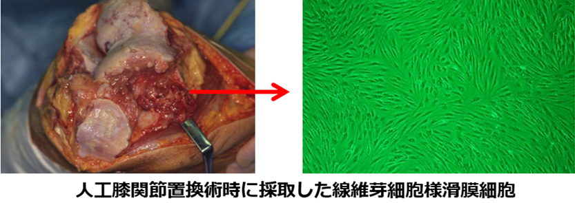人工膝関節置換術時に採取した繊維芽細胞様滑膜細胞